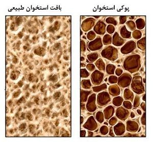 بیماری خاموش چیست؟