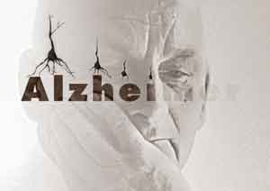 آزمایـش ۳۰ ثانیـه‌ای برای تشخیـص بیماری آلزایمر