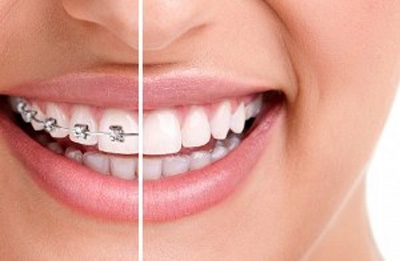 تفاوت دندانپزشک و متخصص ارتودنسی چیست؟