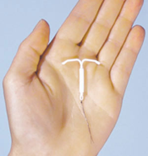 IUD یک روش جلوگیری از بارداری