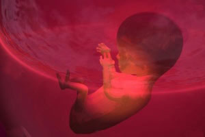 مسمومیت حاملگی و تاثیر آن بر نوزادان