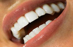 ۵ راهکار ساده برای داشتن دندان‌های سالم