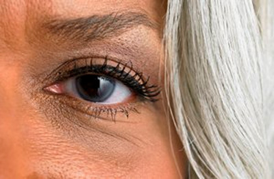 روش های طبیعی برای رفع سیاهی زیر چشم