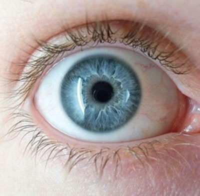شایعترین علائم بیماری‌های چشمی در کودکان