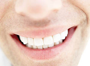 راز دندان‌های سفید و شفاف