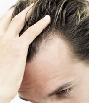 مهمترین علل سفیدی و ریزش مو