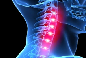 علت بروز آرتروز گردن چیست؟