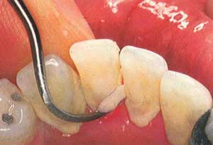 ایمنی در مطب دندانپزشكی