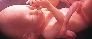 تشخیص جنسیت جنین قبل از ۵ هفتگی