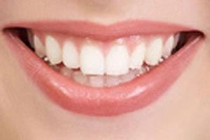 پودر سفیدکننده دندان