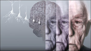 آلزایمر احساسات اطراف را تقلید می کند