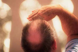 چگونه دچار ریزش مو نشویم؟