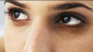 درمان طبیعی حلقه‌های سیاه چشم