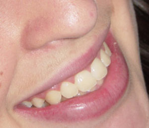 راه حل سفید کردن دندانها را یاد بگیریم