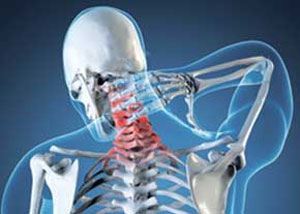 علت بروز آرتروز گردن چیست؟