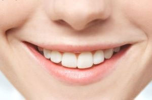آرزو دارید دندانهایتان مثل هالیودی ها سفید، زیبا و درخشان باشد؟