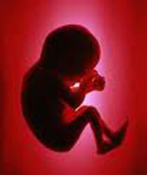 ناهنجاری کروموزمی عامل نیمی از سقط‌هاست