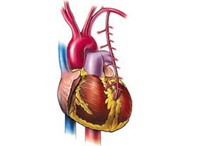 غفلت از کاهش کلسترول و افزایش حمله قلبی