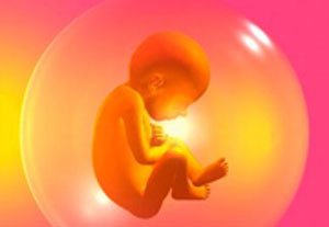 افزایش مایع اطراف جنین