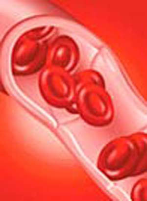 چگونه بفهمیم کم خونی داریم؟