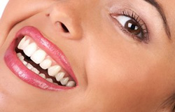 سفید کردن دندان با ۴ روش طبیعی