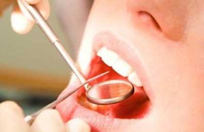 لمینت در چه صورت برای دندان مضر است؟