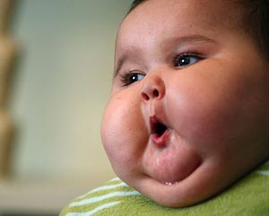 چاقی کودکان معضل قرن بیست و یک