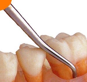 ضرورت توجه به بهداشت دهان و دندان در سالمندان