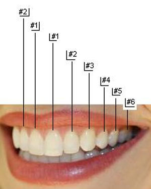 شماره‎گذاری دندان‎ها