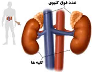 علائم پرکاری غدد فوق کلیوی