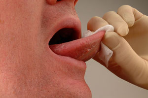 پیشگیری از سرطان دهان
