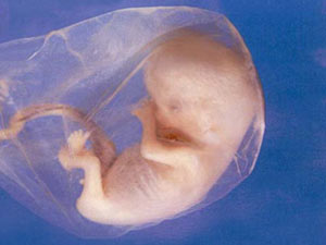 تعیین جنسیت جنین! پسر می خواهید یا دختر؟