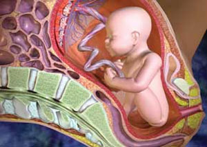 علت رشد ناقص جنین داخل رحم چیست؟
