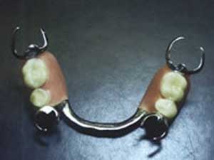 جرم دندان