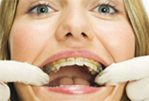 داروی آشکارساز پلاک دندان در خدمت شماست!