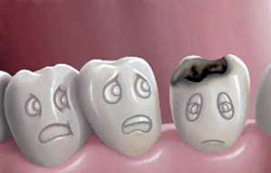 ۳ خطر در کمین دندان های کودکان