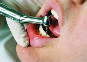 راهکارهای مراقبت از دندان کودکان
