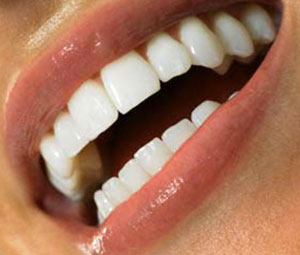 اسراری برای حفظ سفیدی دندان‌ها