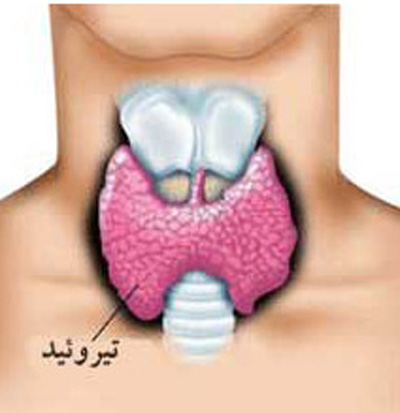 مقایسه بیماری تیروئید در طبایع مختلف