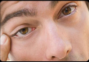 سندروم خشکی چشم قابل درمان است