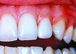 وسایل کمکی در بهداشت دندان
