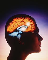 سکته‌های مغزی و روش‌های تشخیص آن