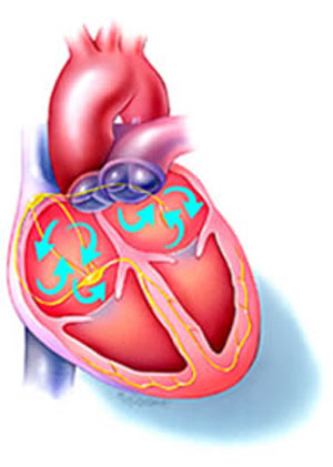 درباره اختلال ریتم قلب