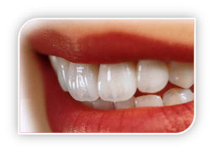 دندانهای سفید