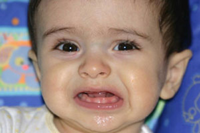 عوارض درآوردن دندان در کودکان