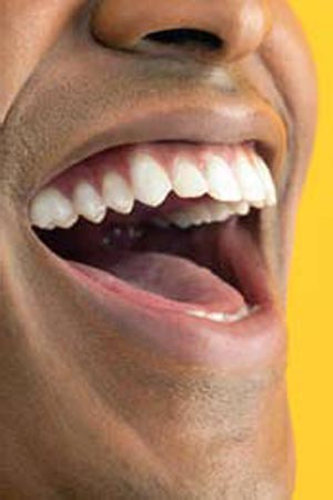 خطاهای سفید کردن دندان