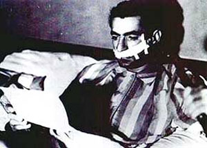 وقتی محمدرضا پهلوی مجبور به جراحی زیبایی شد