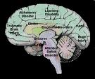 موسیقی دانان قسمت های بیشتری از مغز را فعال می سازند