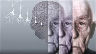 تاخیر در بازنشستگی خطر آلزایمر را کاهش میدهد