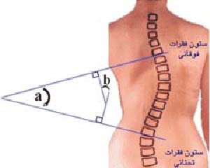 مهمترین استخوان بدن کدام است؟